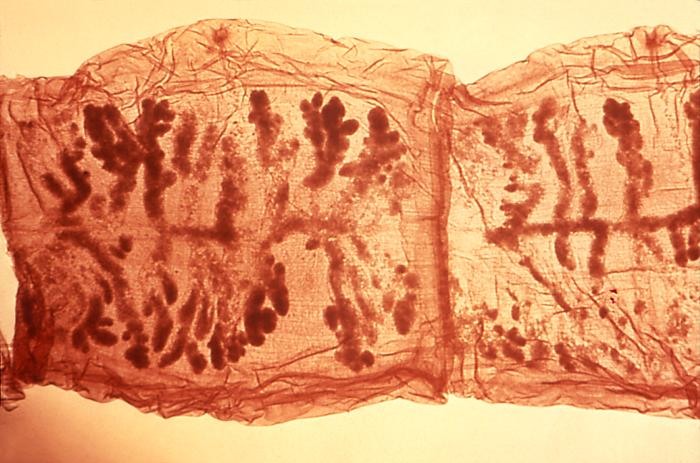 Taenia solium gravid segment