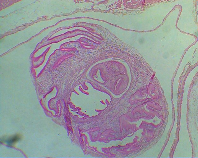 Section in cysticercus cellulosae