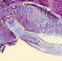 Adult Taenia in small intestine