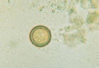 Taenia solium egg